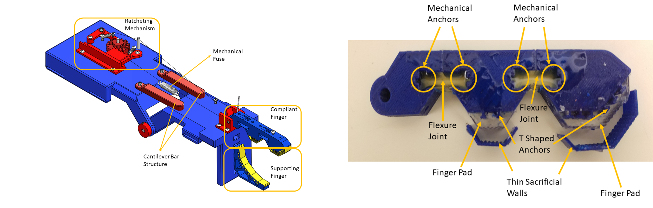 prosthetic hand